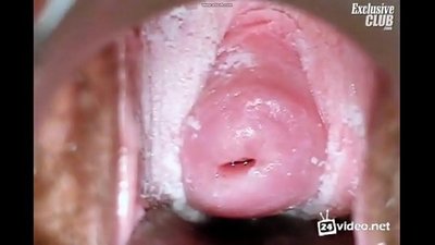 Ginekologia ekzameno de bela virino